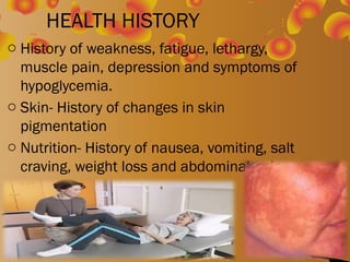 addison disease and its management adults.ppt