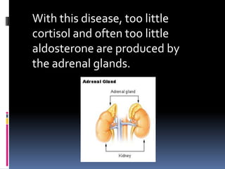 With this disease, too little
cortisol and often too little
aldosterone are produced by
the adrenal glands.
 