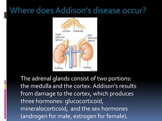 Where does Addison’s disease occur?




  The adrenal glands consist of two portions:
  the medulla and the cortex. Addison’s results
  from damage to the cortex, which produces
  three hormones: glucocorticoid,
  mineralocorticoid, and the sex hormones
  (androgen for male, estrogen for female).
 