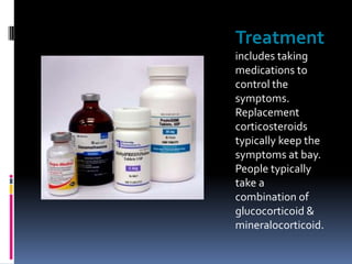 Treatment
includes taking
medications to
control the
symptoms.
Replacement
corticosteroids
typically keep the
symptoms at bay.
People typically
take a
combination of
glucocorticoid &
mineralocorticoid.
 