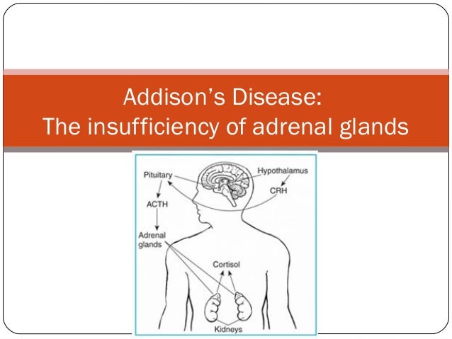 Addison S Disease