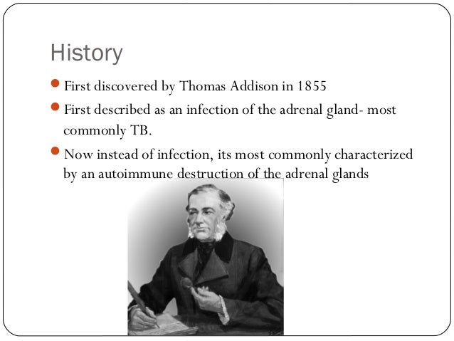 Addison’s disease