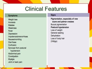 Clinical Features
 
