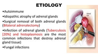 ETIOLOGY
•Autoimmune
•Idiopathic atrophy of adrenal glands
•Surgical removal of both adrenal glands
(Bilateral adrenalectomy)
•Infection of adrenal glands (Tuberculosis
[20%] and histoplasmosis are the most
common infections that destroy adrenal
gland tissue)
•Fungal infections
 