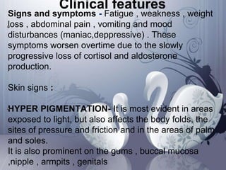 Addison’s disease important DR. Aijin.A.Mohan | PPTX