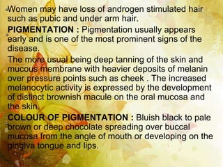 Addison’s disease important DR. Aijin.A.Mohan | PPTX