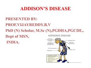 ADDISON’S DISEASE
PRESENTED BY:
PROF.VIJAYREDDY.B.V
PhD (N) Scholar, M.Sc (N),PGDHA,PGCDE,.
Dept of MSN,
INDIA.
 