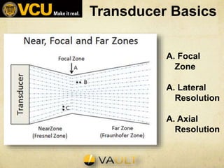 Transducer Basics
A. Focal
Zone
A. Lateral
Resolution
A. Axial
Resolution
 