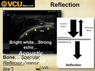 Reflection
Bone… Specular
Reflector (“mirror
like”)
Bright white…Strong
echo…
Acoustic
Impedance
 