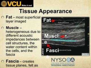 Fat – most superficial
layer imaged
Muscle –
heterogeneous due to
different acoustic
impedances between
cell structures, t...