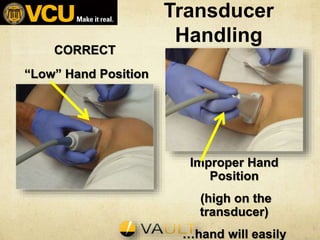 Transducer
Handling
CORRECT
“Low” Hand Position
Improper Hand
Position
(high on the
transducer)
…hand will easily
 