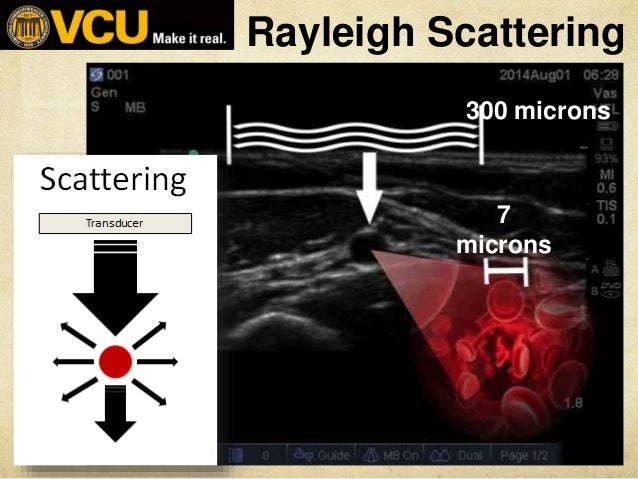 Addition of ultrasound