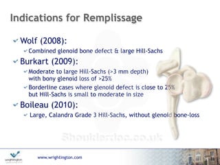www.wrightington.com
Indications for Remplissage
Wolf (2008):
Combined glenoid bone defect & large Hill-Sachs
Burkart (2009):
Moderate to large Hill-Sachs (>3 mm depth)  
with bony glenoid loss of >25%
Borderline cases where glenoid defect is close to 25%  
but Hill-Sachs is small to moderate in size
Boileau (2010):
Large, Calandra Grade 3 Hill-Sachs, without glenoid bone-loss
15
 