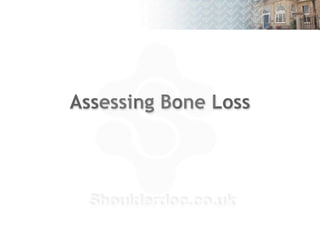 Assessing Bone Loss
16
 