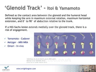 www.wrightington.com
‘Glenoid Track’ - Itoi & Yamamoto
Yamamoto - Cadaver
Metzger - MRI/MRA
Omori - In-vivo
18
Yamamoto N, Itoi E, Abe H, et al. JSES 2007 
Metzger et al. AAOSM, 2010 
Omori et al. AJSM. March 2014.
Defined as the contact area between the glenoid and the humeral head
while keeping the arm in maximum external rotation, maximum horizontal
extension, and 0° to 90° of abduction relative to the trunk.
"
If a Hill-Sachs lesion extends medially over the glenoid track, there is a
risk of engagement.
 