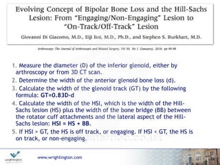 www.wrightington.com
1. Measure the diameter (D) of the inferior glenoid, either by
arthroscopy or from 3D CT scan.
2. Determine the width of the anterior glenoid bone loss (d).
3. Calculate the width of the glenoid track (GT) by the following
formula: GT=0.83D-d
4. Calculate the width of the HSI, which is the width of the Hill-
Sachs lesion (HS) plus the width of the bone bridge (BB) between
the rotator cuff attachments and the lateral aspect of the Hill-
Sachs lesion: HSI = HS + BB.
5. If HSI > GT, the HS is off track, or engaging. If HSI < GT, the HS is
on track, or non-engaging.
21
 