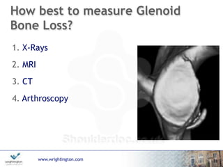www.wrightington.com
How best to measure Glenoid
Bone Loss?
1. X-Rays
2. MRI
3. CT
4. Arthroscopy
3
 