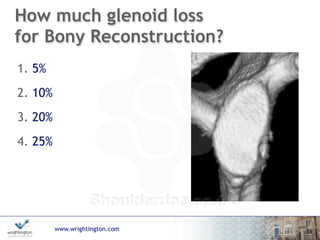 www.wrightington.com
How much glenoid loss  
for Bony Reconstruction?
1. 5%
2. 10%
3. 20%
4. 25%
 