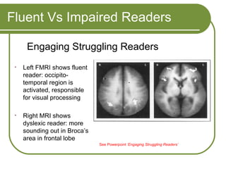 Fluent Vs Impaired Readers Left FMRI shows fluent reader: occipito-temporal region is activated, responsible for visual processing Right MRI shows dyslexic reader: more sounding out in Broca’s area in frontal lobe Engaging Struggling Readers See Powerpoint  ‘Engaging Struggling Readers’ 