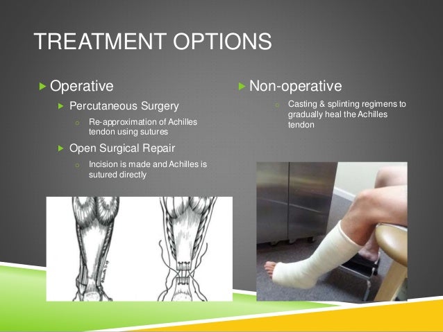 Achilles Tendon Presentation2013