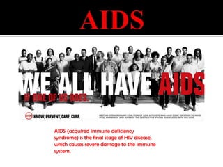 AIDSAIDS (acquired immune deficiency syndrome) is the final stage of HIV disease, which causes severe damage to the immune system.