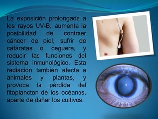 La exposición prolongada a
los rayos UV-B, aumenta la
posibilidad de contraer
cáncer de piel, sufrir de
cataratas o ceguera, y
reducir las funciones del
sistema inmunológico. Esta
radiación también afecta a
animales y plantas, y
provoca la pérdida del
fitoplancton de los océanos,
aparte de dañar los cultivos.
 