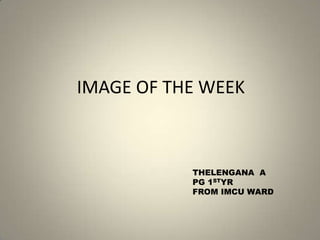 IMAGE OF THE WEEK



           THELENGANA A
           PG 1STYR
           FROM IMCU WARD
 