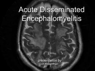 Acute Disseminated
Encephalomyelitis
presentation by
Dr.Aheed Khan
 