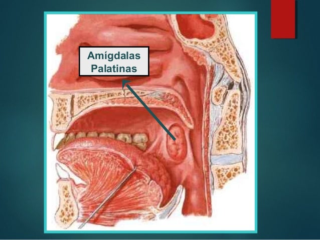 ADENOIDECTOMÍA AMIGDALECTOMÍA
