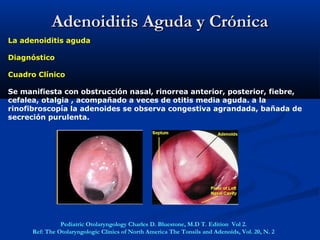 Adenoiditis Aguda y CrónicaAdenoiditis Aguda y Crónica
La adenoiditis aguda
Diagnóstico
Cuadro Clínico
Se manifiesta con obstrucción nasal, rinorrea anterior, posterior, fiebre,
cefalea, otalgia , acompañado a veces de otitis media aguda. a la
rinofibroscopía la adenoides se observa congestiva agrandada, bañada de
secreción purulenta.
Pediatric Otolaryngology Charles D. Bluestone, M.D T. Edition Vol 2.
Ref: The Otolaryngologic Clinics of North America The Tonsils and Adenoids, Vol. 20, N. 2
 