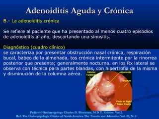 Adenoiditis Aguda y CrónicaAdenoiditis Aguda y Crónica
B.- La adenoiditis crónica
Se refiere al paciente que ha presentado al menos cuatro episodios
de adenoiditis al año, descartando una sinusitis.
Diagnóstico (cuadro clínico)
se caracteriza por presentar obstrucción nasal crónica, respiración
bucal, babeo de la almohada, tos crónica intermitente por la rinorrea
posterior que presenta; generalmente nocturna. en los Rx lateral se
observa con técnica para partes blandas, con hipertrofia de la misma
y disminución de la columna aérea.
Pediatric Otolaryngology Charles D. Bluestone, M.D T. Edition Vol 2.
Ref: The Otolaryngologic Clinics of North America The Tonsils and Adenoids, Vol. 20, N. 2
 