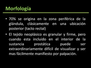 Morfología 70% se origina en la zona periférica de la glándula, clásicamente en una ubicación posterior (tacto rectal)El tejido neoplásico es granular y firme, pero cuando esta incluido en el interior de la sustancia prostática puede ser extraordinariamente difícil de visualizar y ser mas fácilmente manifiesto por palpación.