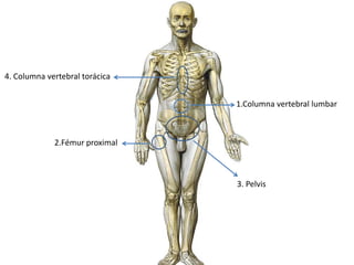 4. Columna vertebral torácica 1.Columna vertebral lumbar2.Fémur proximal3. Pelvis