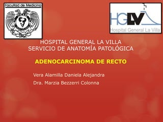 HOSPITAL GENERAL LA VILLA
SERVICIO DE ANATOMÍA PATOLÓGICA
ADENOCARCINOMA DE RECTO
Vera Alamilla Daniela Alejandra
Dra. Marzia Bezzerri Colonna
 
