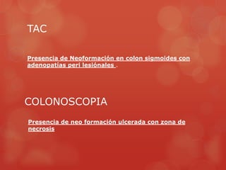 TAC
Presencia de Neoformación en colon sigmoides con
adenopatías peri lesiónales .
COLONOSCOPIA
Presencia de neo formación ulcerada con zona de
necrosis
 