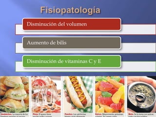 Disminución del volumen


Aumento de bilis


Disminución de vitaminas C y E
 
