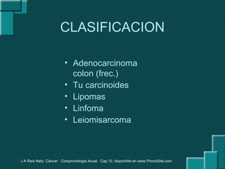 CLASIFICACION
• Adenocarcinoma
colon (frec.)
• Tu carcinoides
• Lipomas
• Linfoma
• Leiomisarcoma
J A Reis Neto. Cáncer Coloproctologia Acual. Cap 12. disponible en www.ProctoSite.com
 