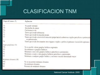 CLASIFICACION TNM
National Cancer Institute. 2005
 