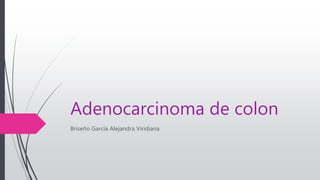 Adenocarcinoma de colon
Briseño García Alejandra Viridiana
 