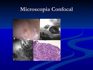 Microscopia Confocal
 