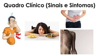 Quadro Clínico (Sinais e Sintomas)
 