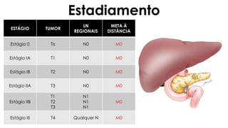 Estadiamento
ESTÁGIO TUMOR
LN
REGIONAIS
META À
DISTÂNCIA
Estágio 0 Tis N0 M0
Estágio IA T1 N0 M0
Estágio IB T2 N0 M0
Estágio IIA T3 N0 M0
Estágio IIB
T1
T2
T3
N1
N1
N1
M0
Estágio III T4 Qualquer N M0
 