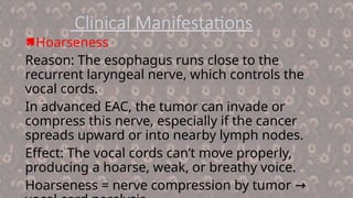 Adenocarcinoma(Esophageal) clinical features, and relevant Medical ...