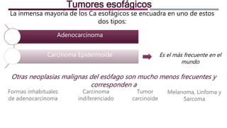 Adenocarcinoma
Carcinoma Epidermoide
La inmensa mayoría de los Ca esofágicos se encuadra en uno de estos
dos tipos:
Tumores esofágicos
Es el más frecuente en el
mundo
Otras neoplasias malignas del esófago son mucho menos frecuentes y
corresponden a
Formas inhabituales
de adenocarcinoma
Carcinoma
indiferenciado
Tumor
carcinoide
Melanoma, Linfoma y
Sarcoma
 