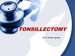 TONSILLECTOMY
By-Dr Shelly Agrawal
 