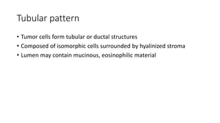Tubular pattern
• Tumor cells form tubular or ductal structures
• Composed of isomorphic cells surrounded by hyalinized stroma
• Lumen may contain mucinous, eosinophilic material
 