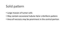Solid pattern
• Large masses of tumor cells
• May contain occasional tubular &/or cribriform pattern
• Area of necrosis may be prominent in the central portion
 