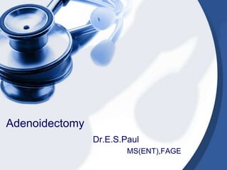 Adenoidectomy
                Dr.E.S.Paul
                        MS(ENT),FAGE
 