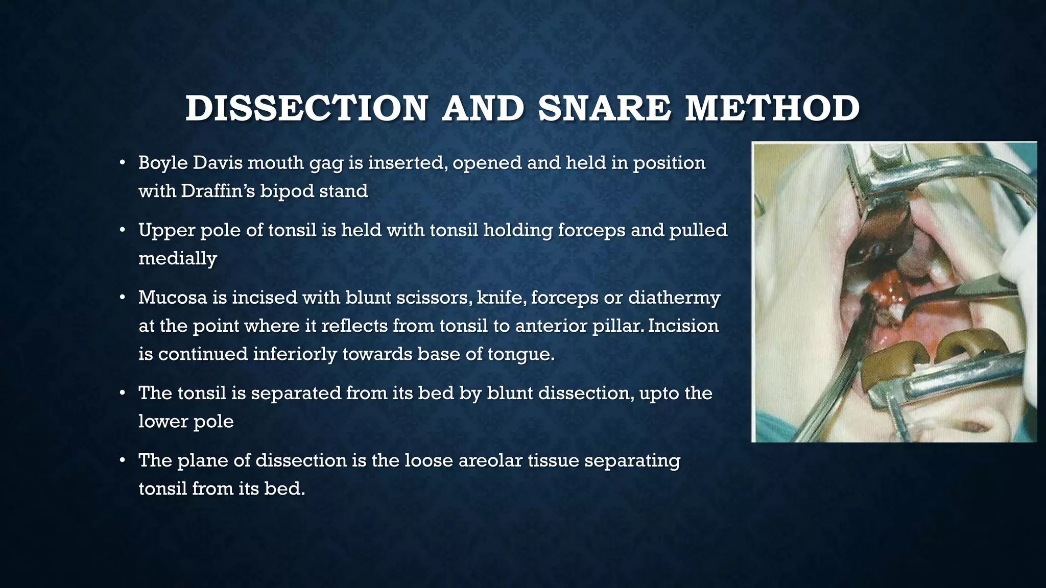 DISSECTION AND SNARE METHOD
• Boyle Davis mouth gag is inserted, opened and held in position
with Draffin’s bipod stand
• Upper pole of tonsil is held with tonsil holding forceps and pulled
medially
• Mucosa is incised with blunt scissors, knife, forceps or diathermy
at the point where it reflects from tonsil to anterior pillar. Incision
is continued inferiorly towards base of tongue.
• The tonsil is separated from its bed by blunt dissection, upto the
lower pole
• The plane of dissection is the loose areolar tissue separating
tonsil from its bed.
 