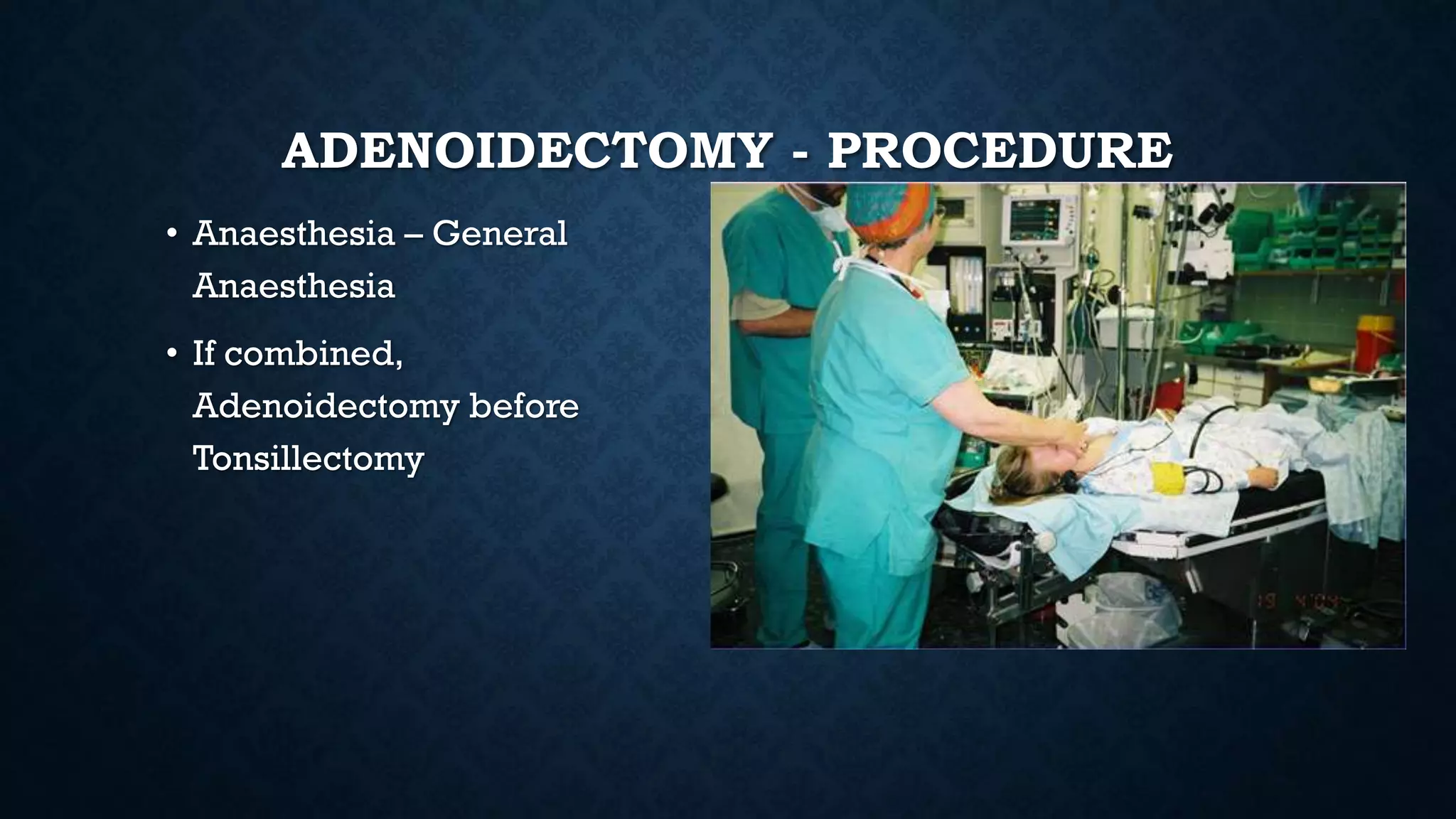 ADENOIDECTOMY - PROCEDURE
• Anaesthesia – General
Anaesthesia
• If combined,
Adenoidectomy before
Tonsillectomy
 